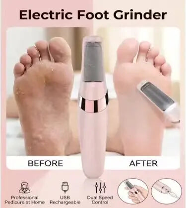 Rechargeable Foot File – Callus & Dry Skin Remover